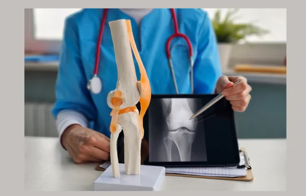 KNEE REPLACEMENT SURGERY